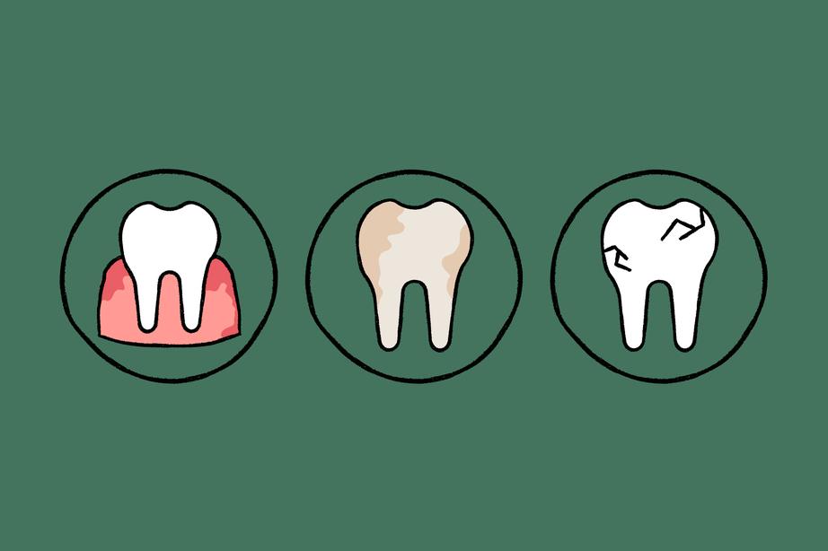 The image shows three circles, each depicting a tooth with a different condition: Inflamed gums, Discoloration, and Cracks